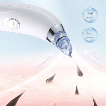 Emily Rose™ Deep Cleansing Blackhead Remover & Facial Vacuum (5 Suction Modes + SkinCare System)